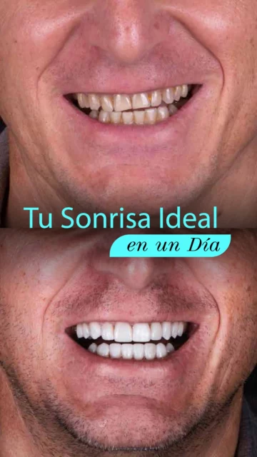 1_SONRISAS_Tu_sonrisa_ideal_en_un_día