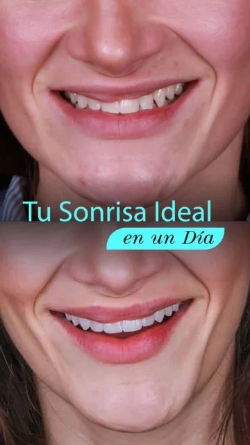 2_SONRISAS_Tu_sonrisa_ideal_en_un_día