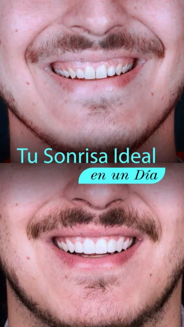3_SONRISAS_Tu_sonrisa_ideal_en_un_día