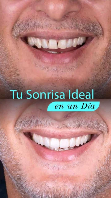 5_SONRISAS_Tu_sonrisa_ideal_en_un_día