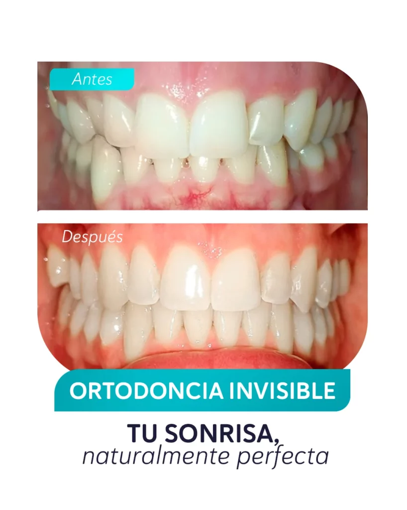 post antes y despues